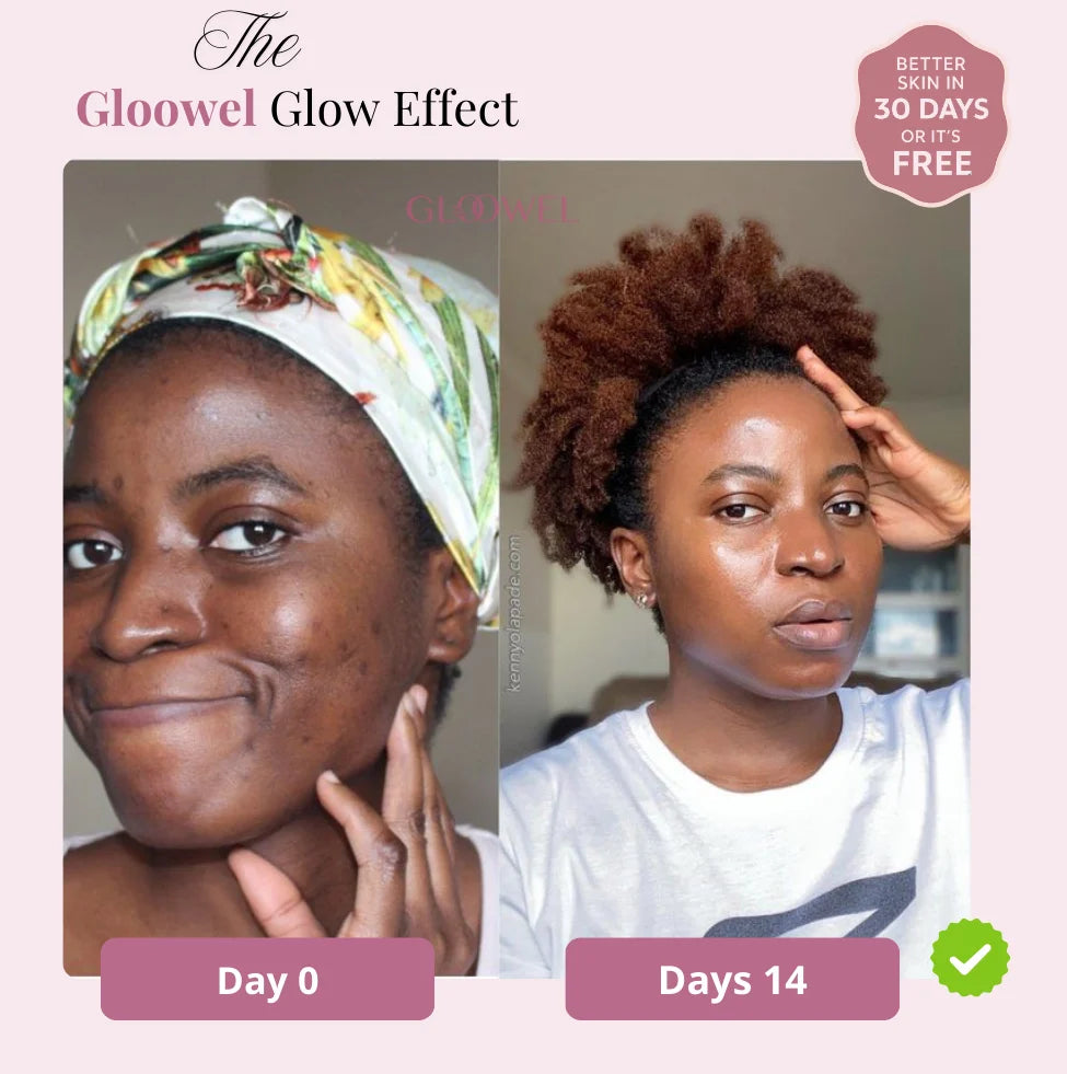 Skin repair kit (1 Bars soap + 1 Cream )