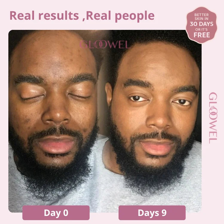 Skin repair kit (1 Bars soap + 1 Cream )