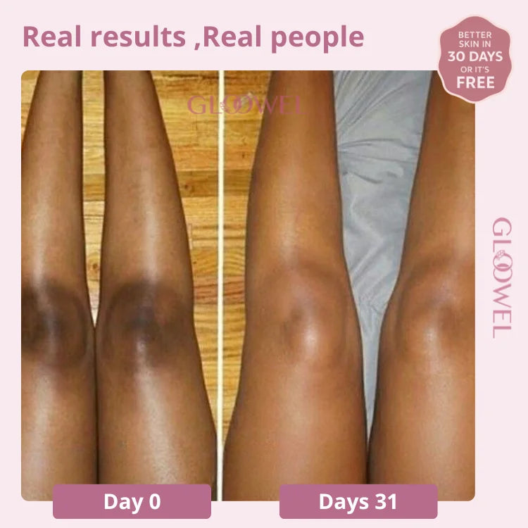 Skin repair kit (1 Bars soap + 1 Cream )