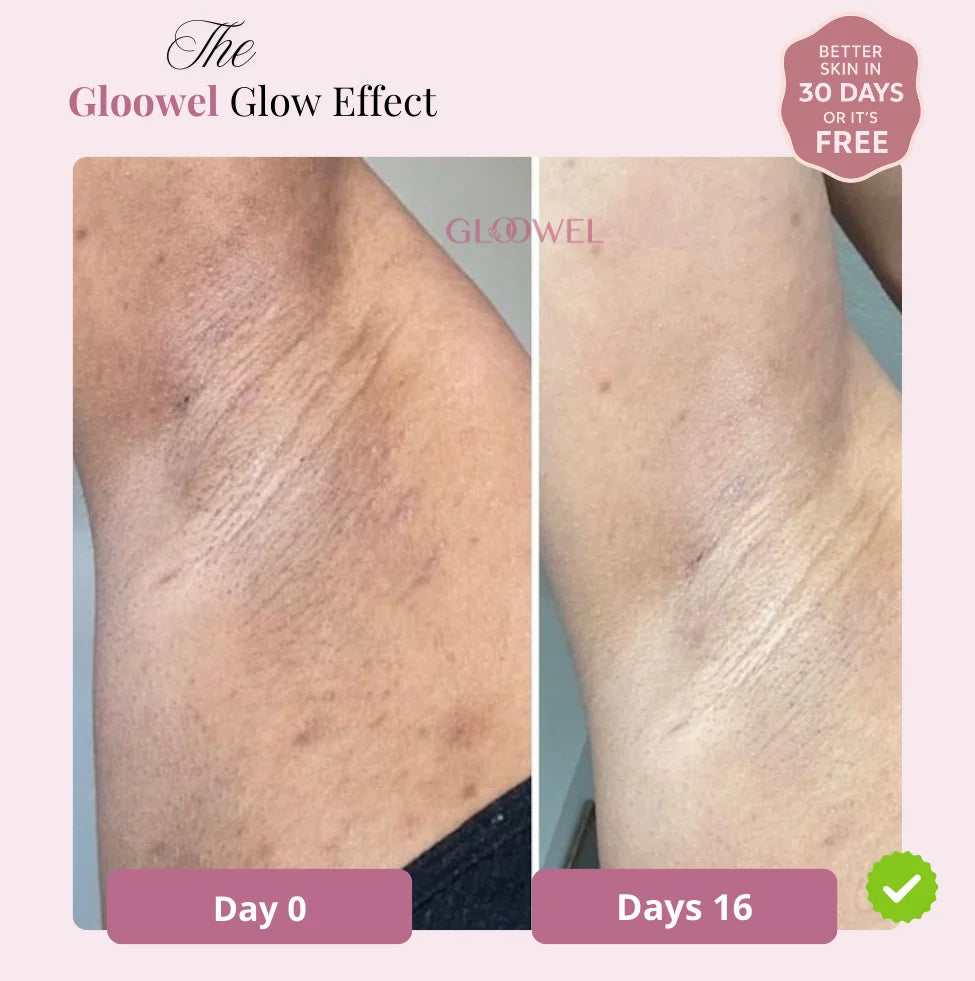 Skin repair kit (1 Bars soap + 1 Cream )