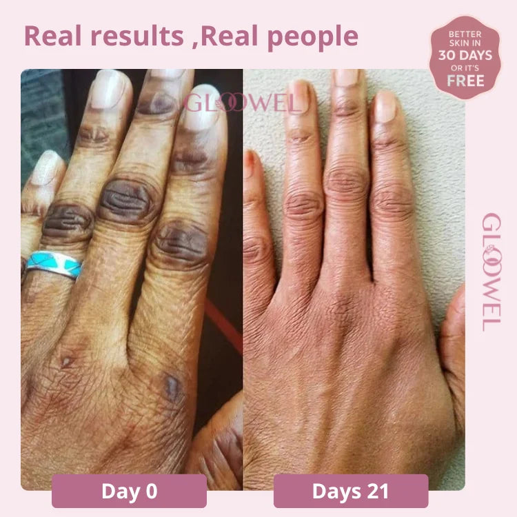 Skin repair kit (1 Bars soap + 1 Cream )