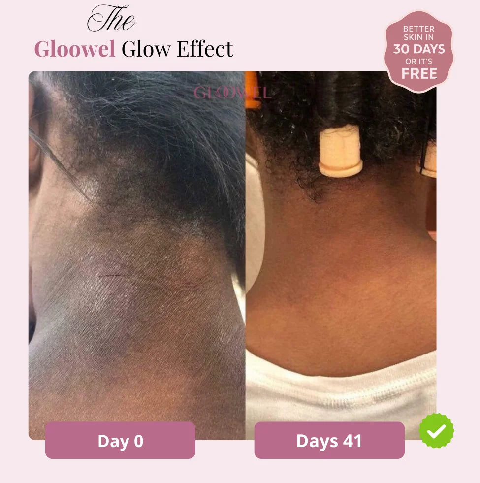 Glow Bar – Kojic Acid & Turmeric Brightening Soap ™