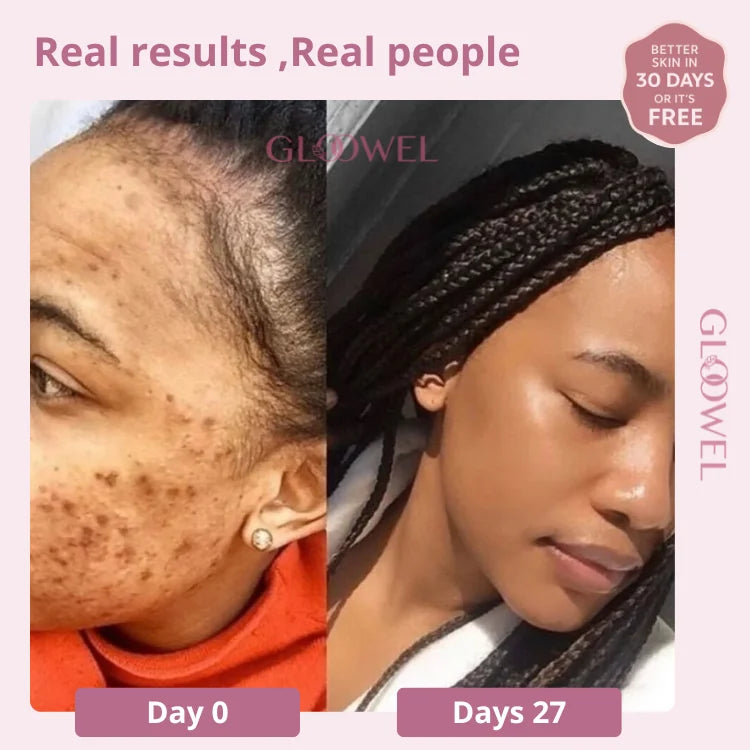 Glow Bar – Kojic Acid & Turmeric Brightening Soap ™