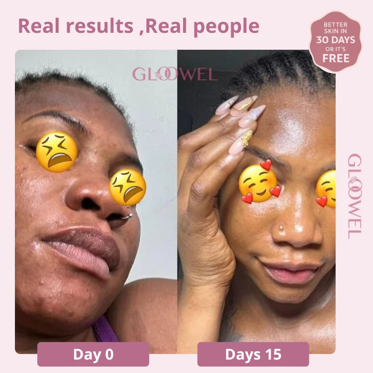 Glow Bar – Kojic Acid & Turmeric Brightening Soap ™