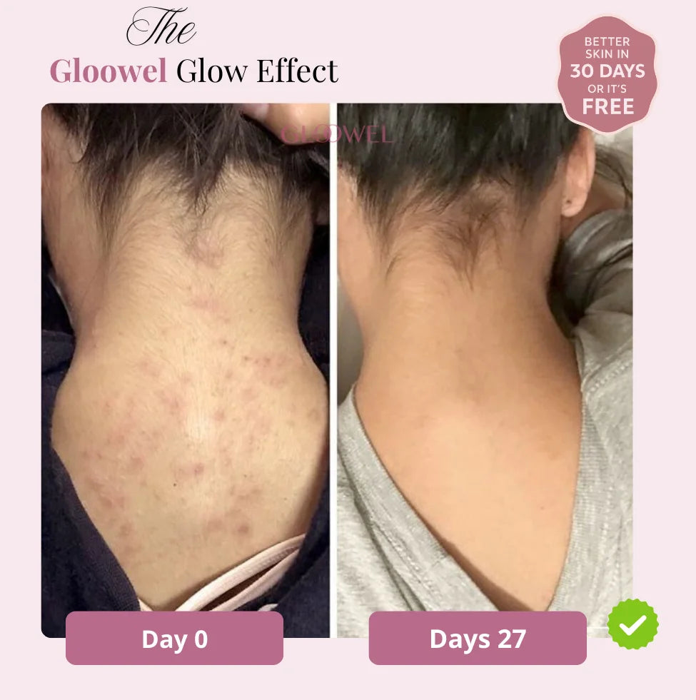 Glow Bar – Kojic Acid & Turmeric Brightening Soap ™