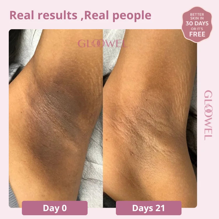 Skin repair kit (1 Bars soap + 1 Cream )