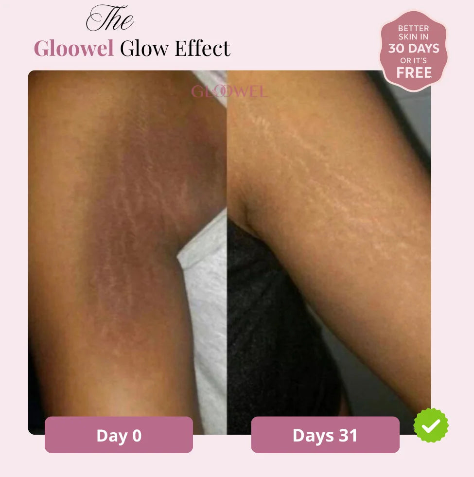 Glow Bar – Kojic Acid & Turmeric Brightening Soap ™