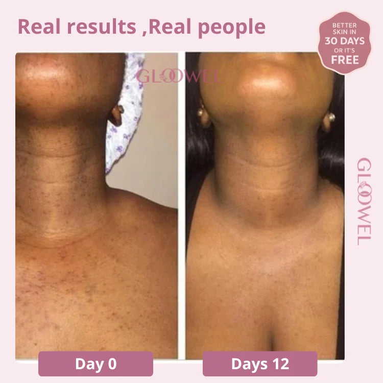 Skin repair kit (1 Bars soap + 1 Cream )