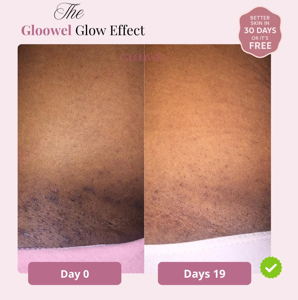 Glow Bar – Kojic Acid & Turmeric Brightening Soap ™