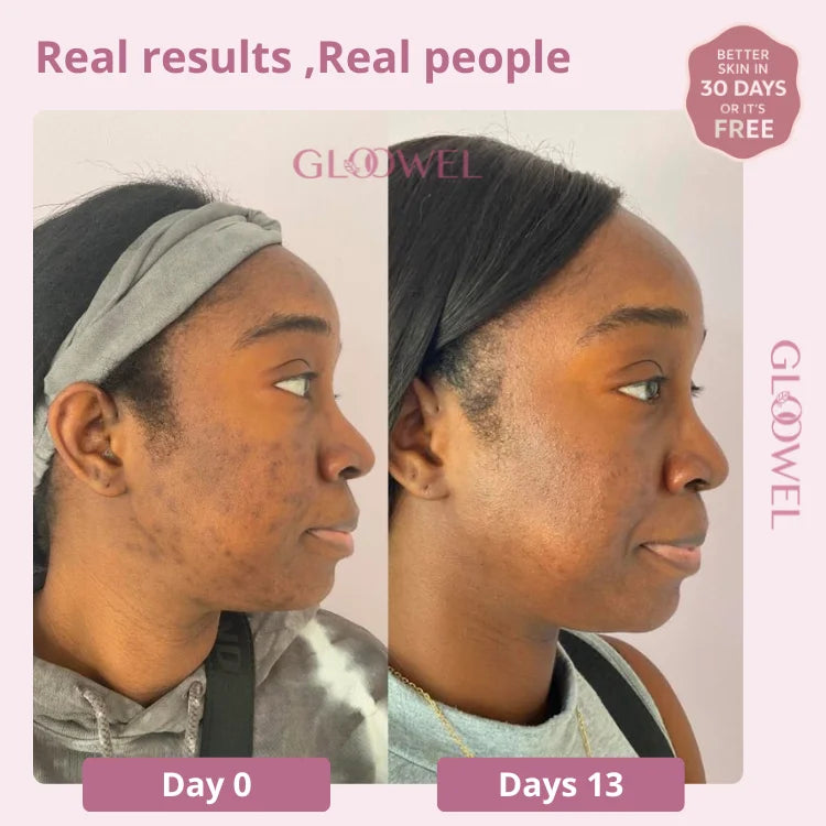 Glow Bar – Kojic Acid & Turmeric Brightening Soap ™