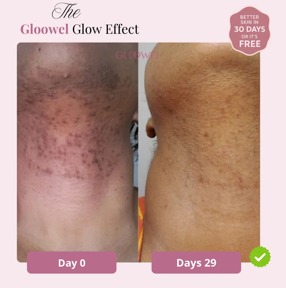 Glow Bar – Kojic Acid & Turmeric Brightening Soap ™