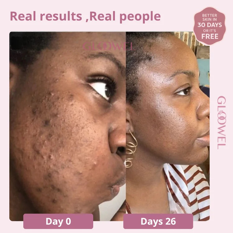 Skin repair kit (1 Bars soap + 1 Cream )