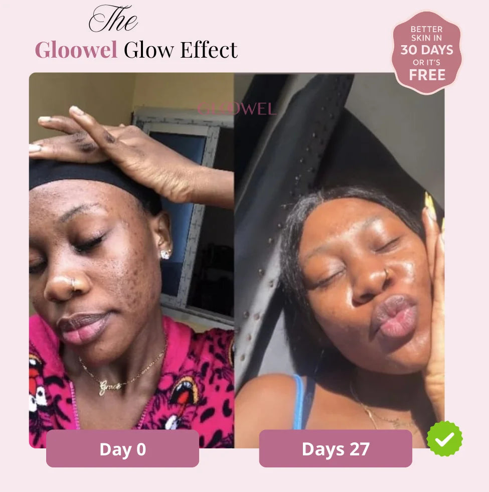 Skin repair kit (1 Bars soap + 1 Cream )