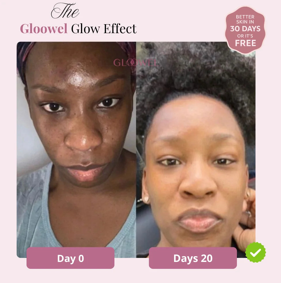 Glow Bar – Kojic Acid & Turmeric Brightening Soap ™