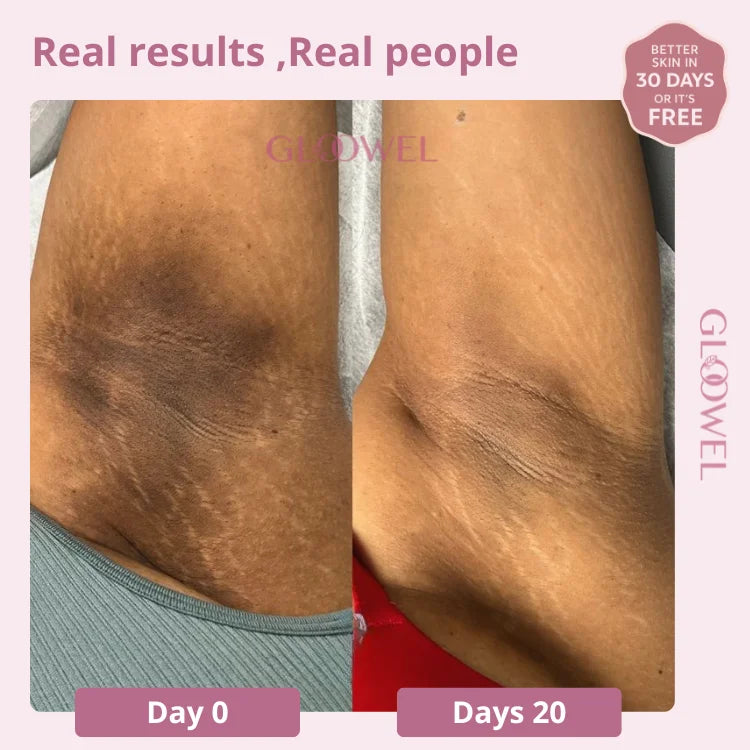 Skin repair kit (1 Bars soap + 1 Cream )